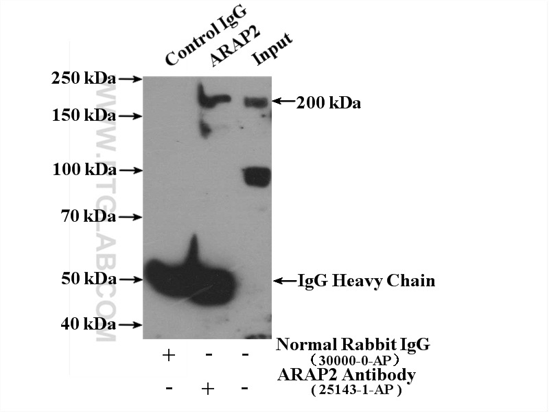 25143-1-AP;mouse brain tissue