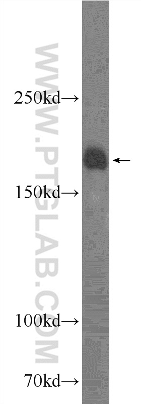 25143-1-AP;mouse brain tissue