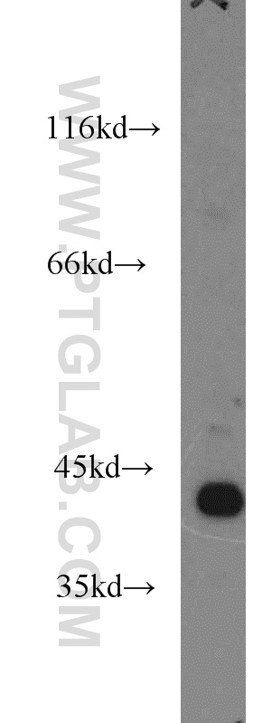 14825-1-AP;HEK-293 cell