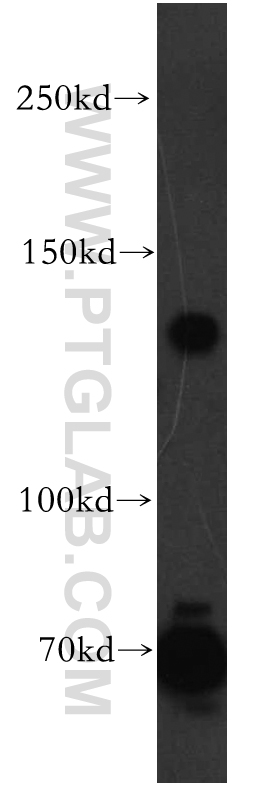 13775-1-AP;human brain tissue