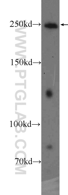 22183-1-AP;PC-3 cells