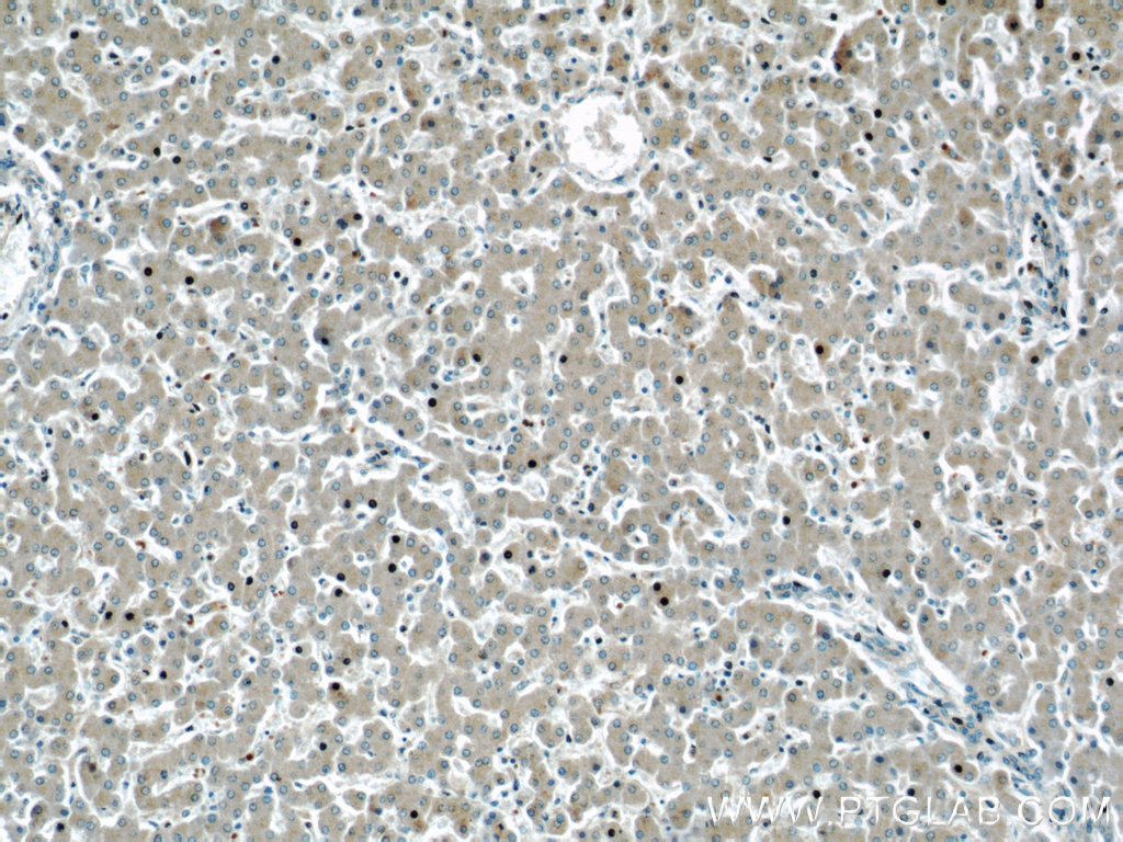 17747-1-AP;human liver tissue