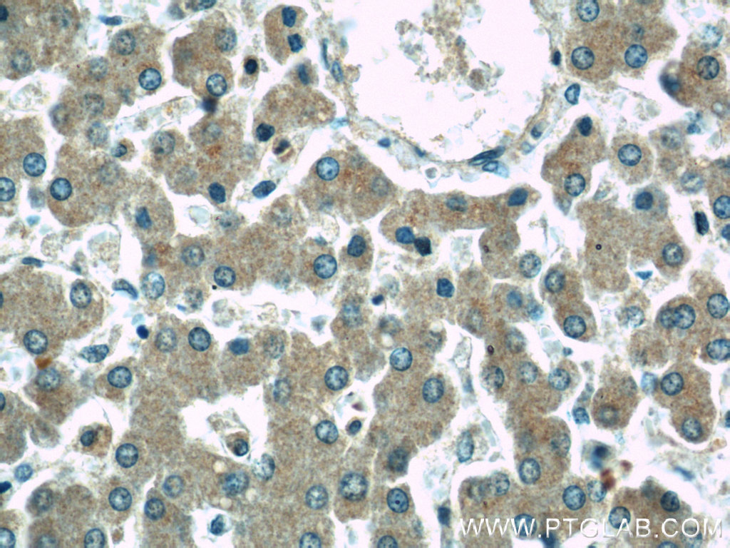 17747-1-AP;human liver tissue