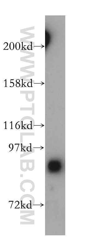 17747-1-AP;HeLa cells