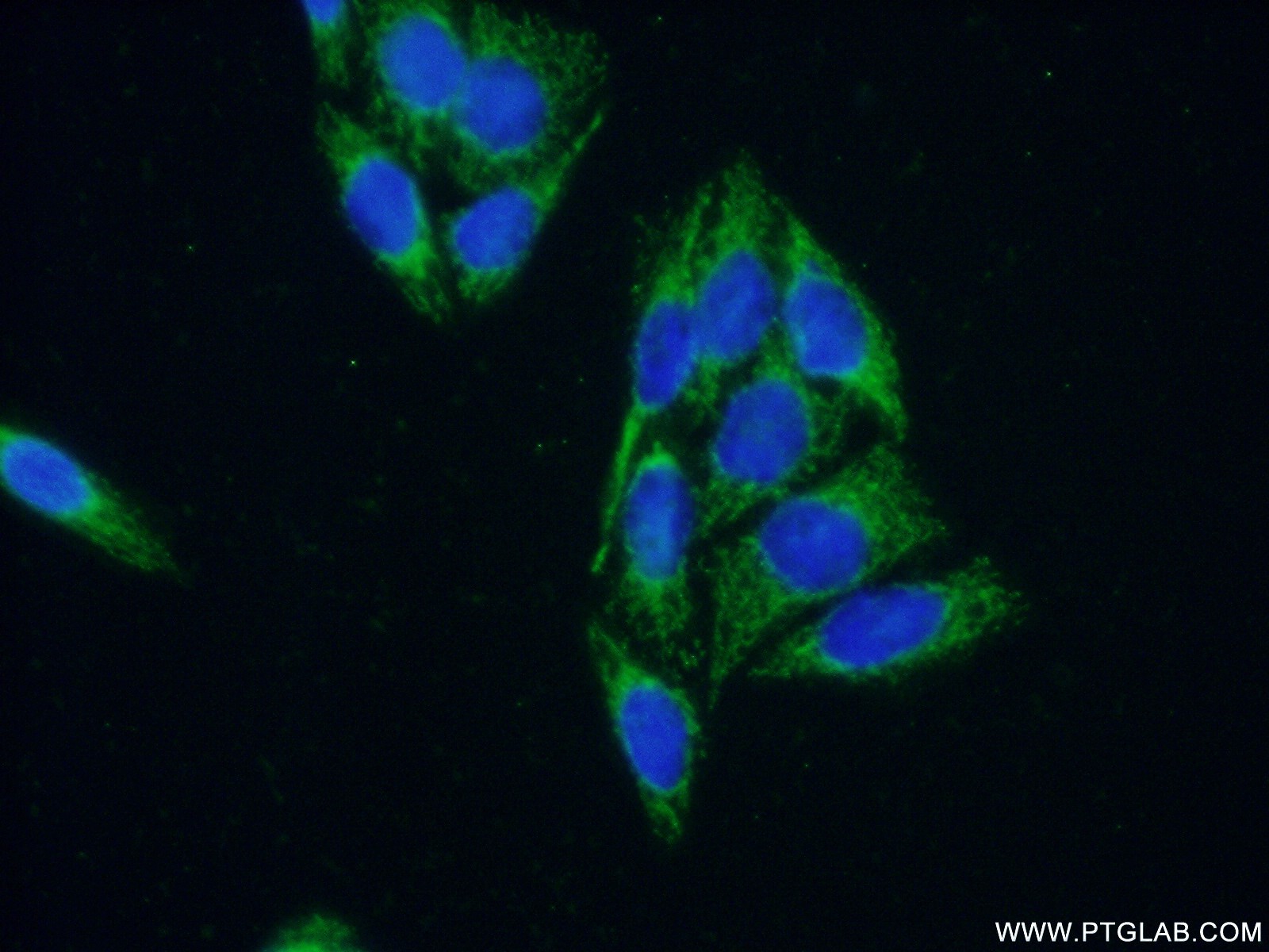 15665-1-AP;HeLa cells