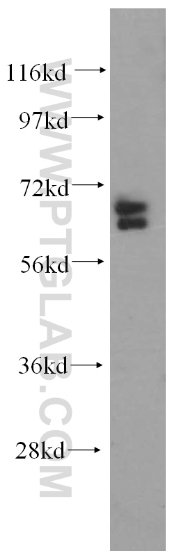 15665-1-AP;Jurkat cells