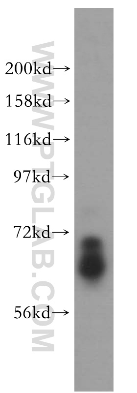 15665-1-AP;HL-60 cells