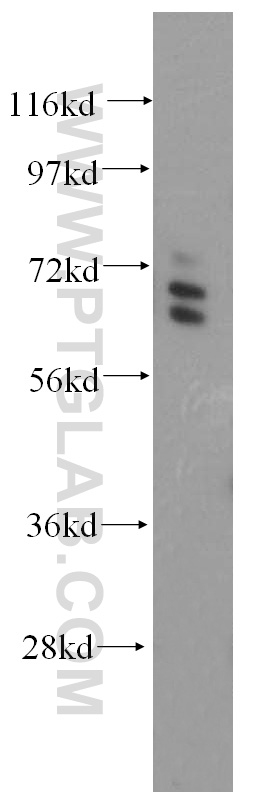 15665-1-AP;HeLa cells