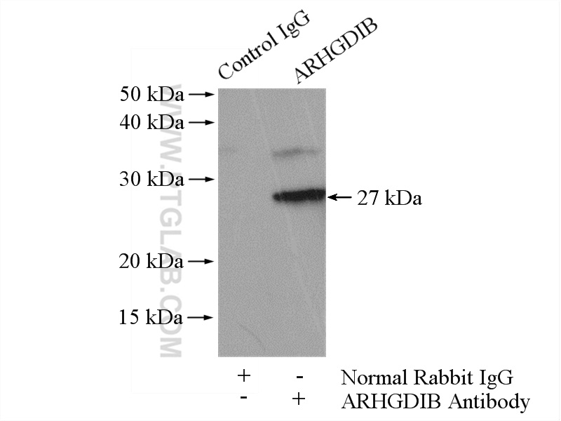 16122-1-AP;Raji cells