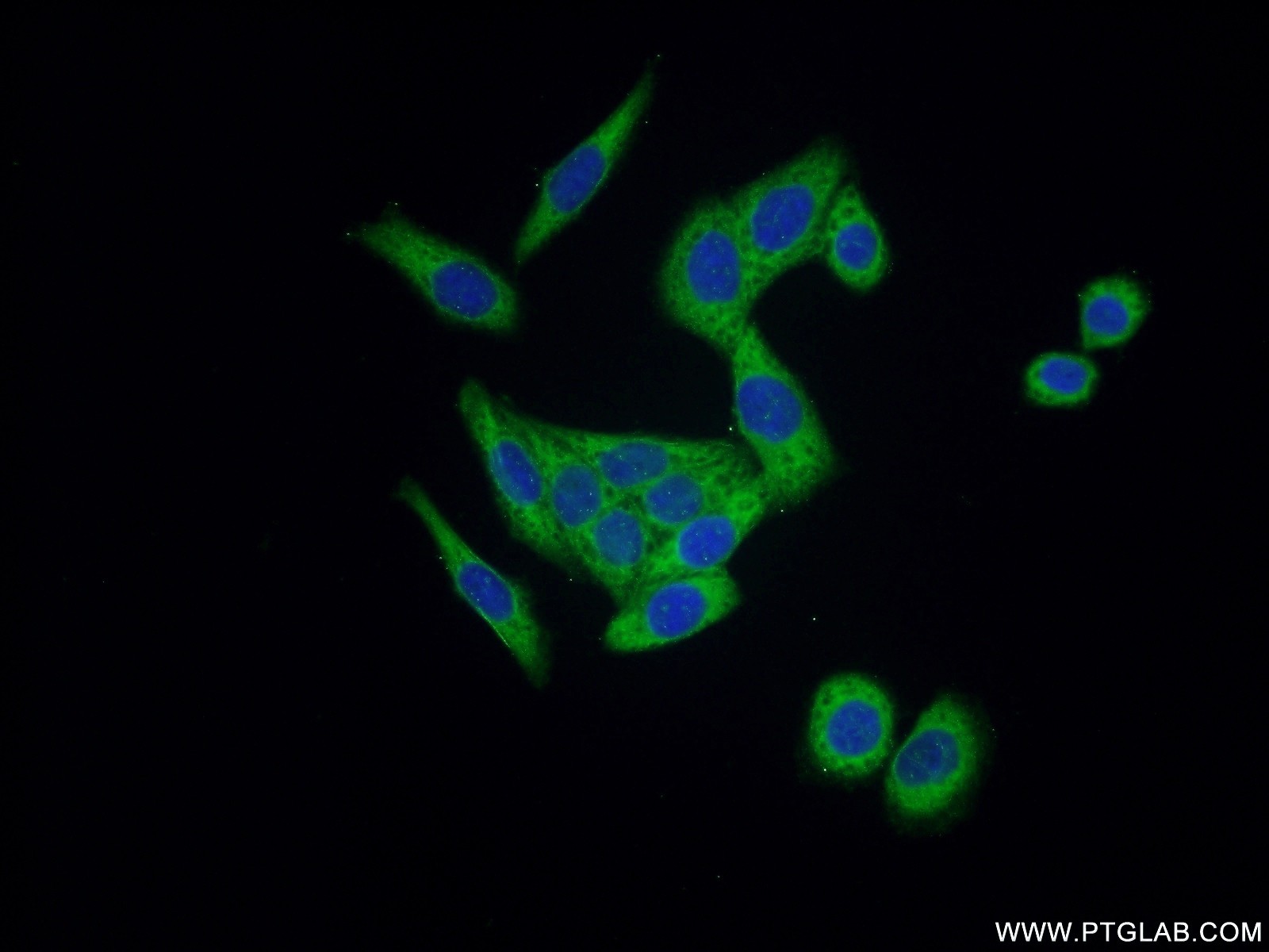 11363-1-AP;HeLa cells