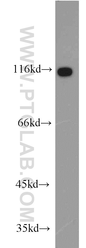 11363-1-AP;HEK-293 cells