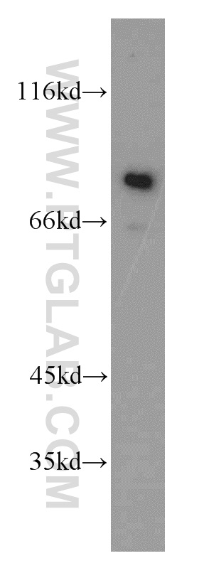 10153-2-AP;mouse kidney tissue