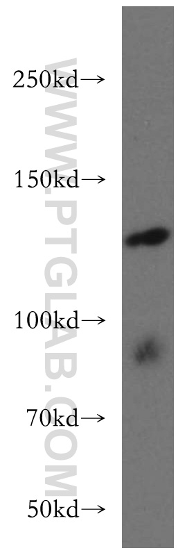 11243-1-AP;mouse testis tissue