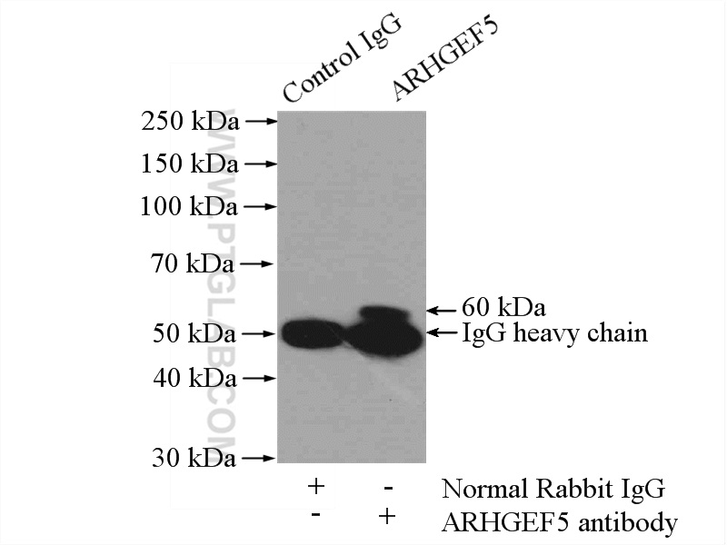 11379-1-AP;mouse kidney tissue