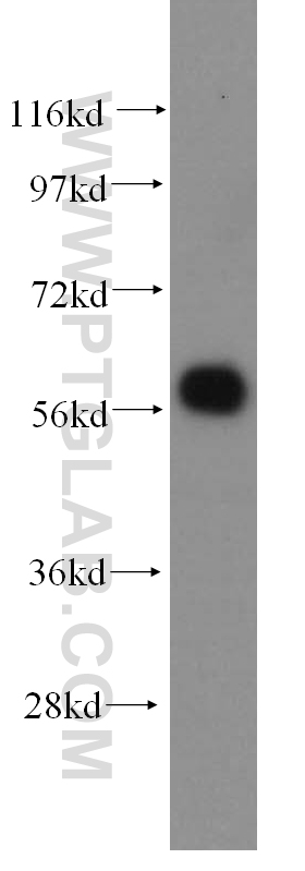 11379-1-AP;MCF7 cell