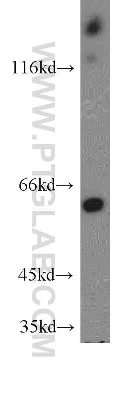 20042-1-AP;HeLa cells