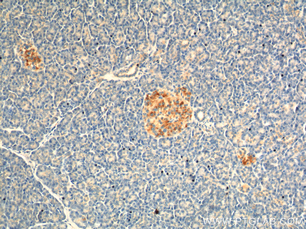 10202-1-AP;human pancreas tissue