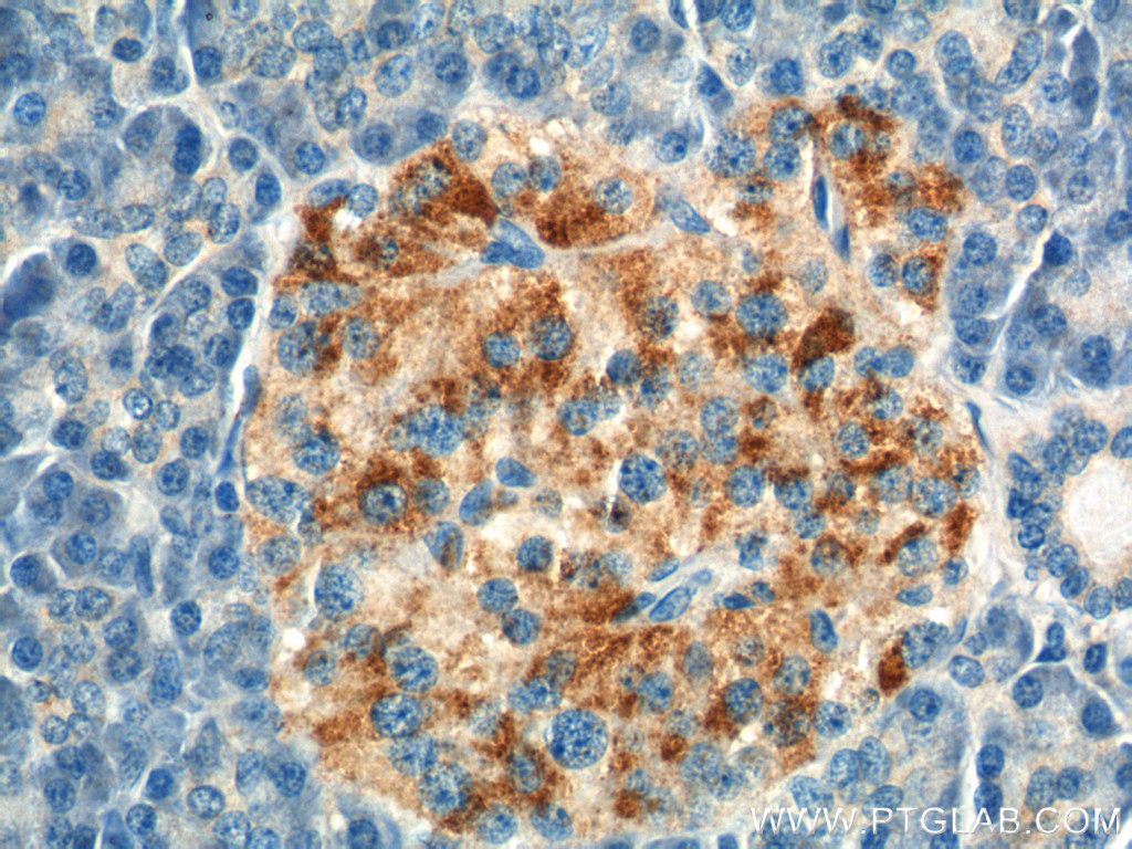 10202-1-AP;human pancreas tissue