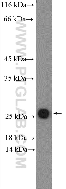 10202-1-AP;HUVEC cells