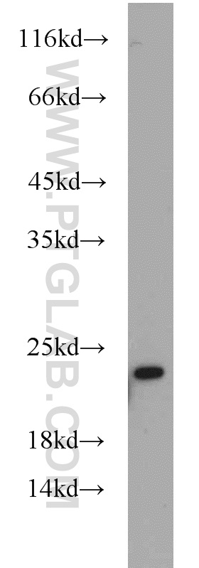 12676-1-AP;human brain tissue