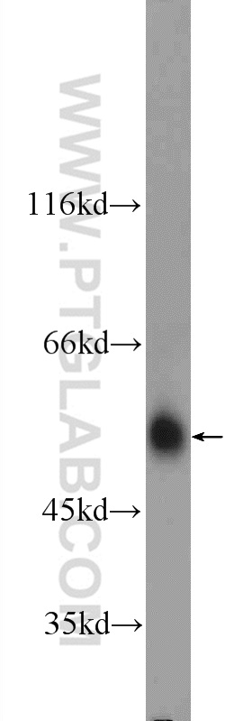 24833-1-AP;mouse brain tissue