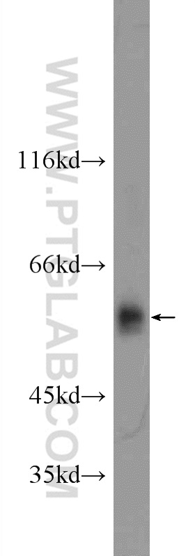 24833-1-AP;mouse liver tissue