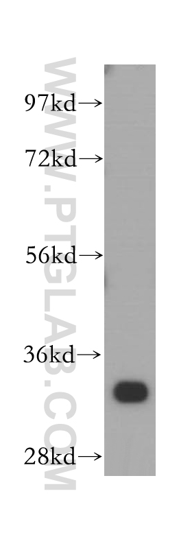 15058-1-AP;MCF7 cells