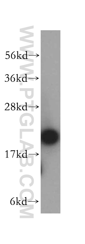 14652-1-AP;K-562 cell