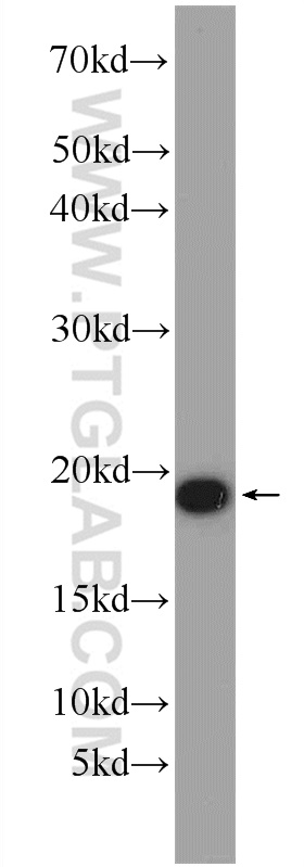 10930-1-AP;mouse brain tissue