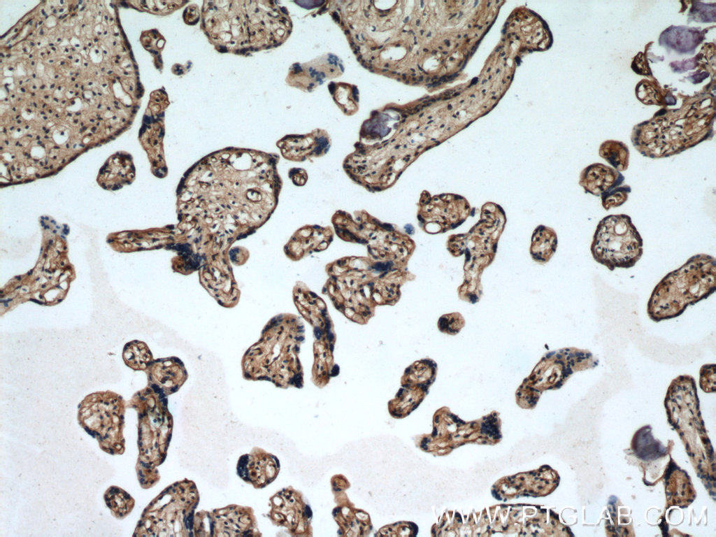 22025-1-AP;human placenta tissue