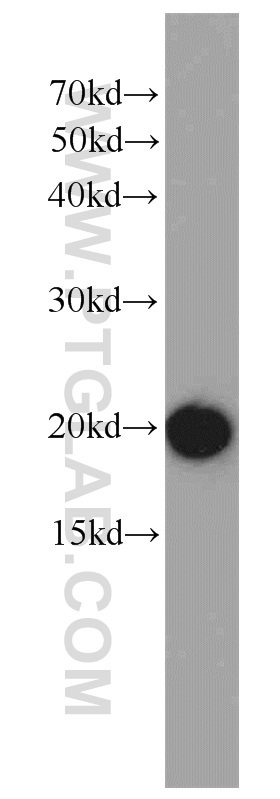 22025-1-AP;mouse brain tissue