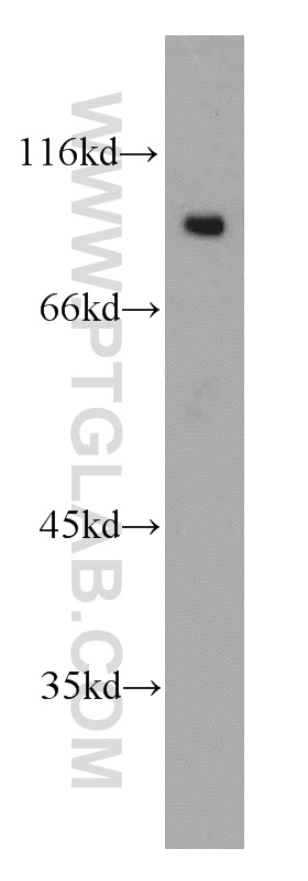 11829-1-AP;mouse brain tissue