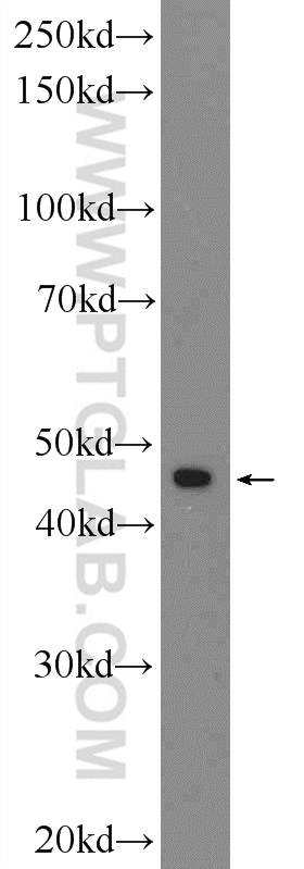 25060-1-AP;MCF-7 cells