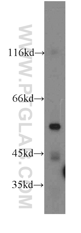 19749-1-AP;HeLa cell