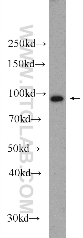 11529-1-AP;HeLa cells