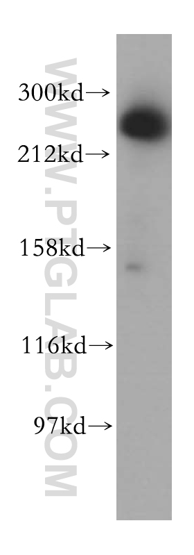 17627-1-AP;HeLa cell