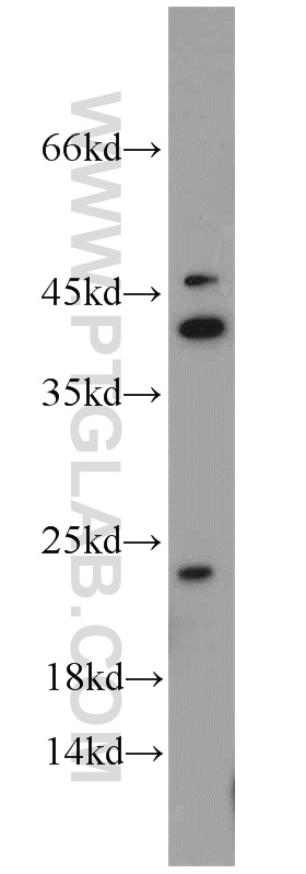 10784-1-AP;HeLa cell