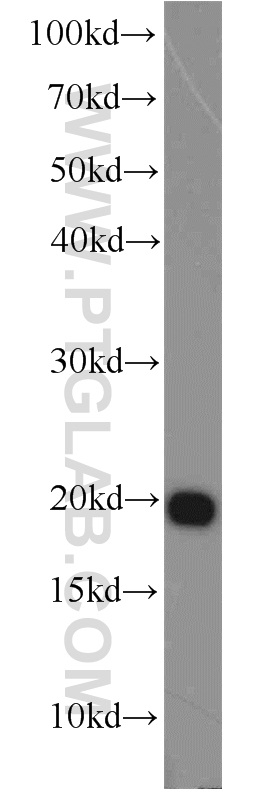 22258-1-AP;HeLa cell