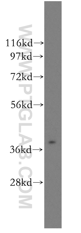 11501-2-AP;human liver tissue