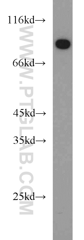 14981-1-AP;human testis tissue