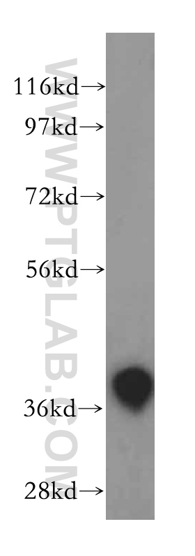 15450-1-AP;human brain tissue