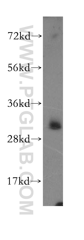 11400-1-AP;HeLa cell