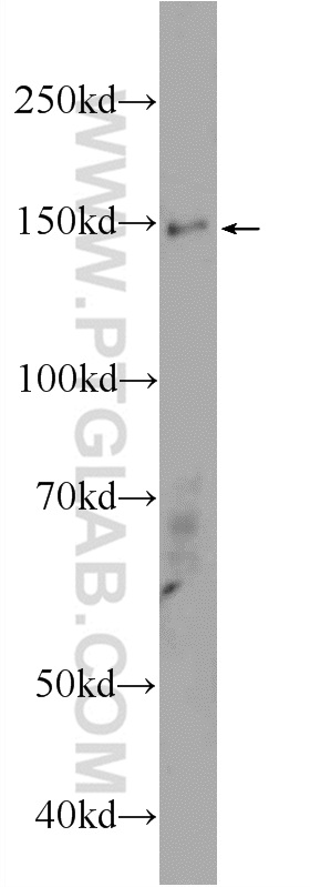 17351-1-AP;HepG2 cells