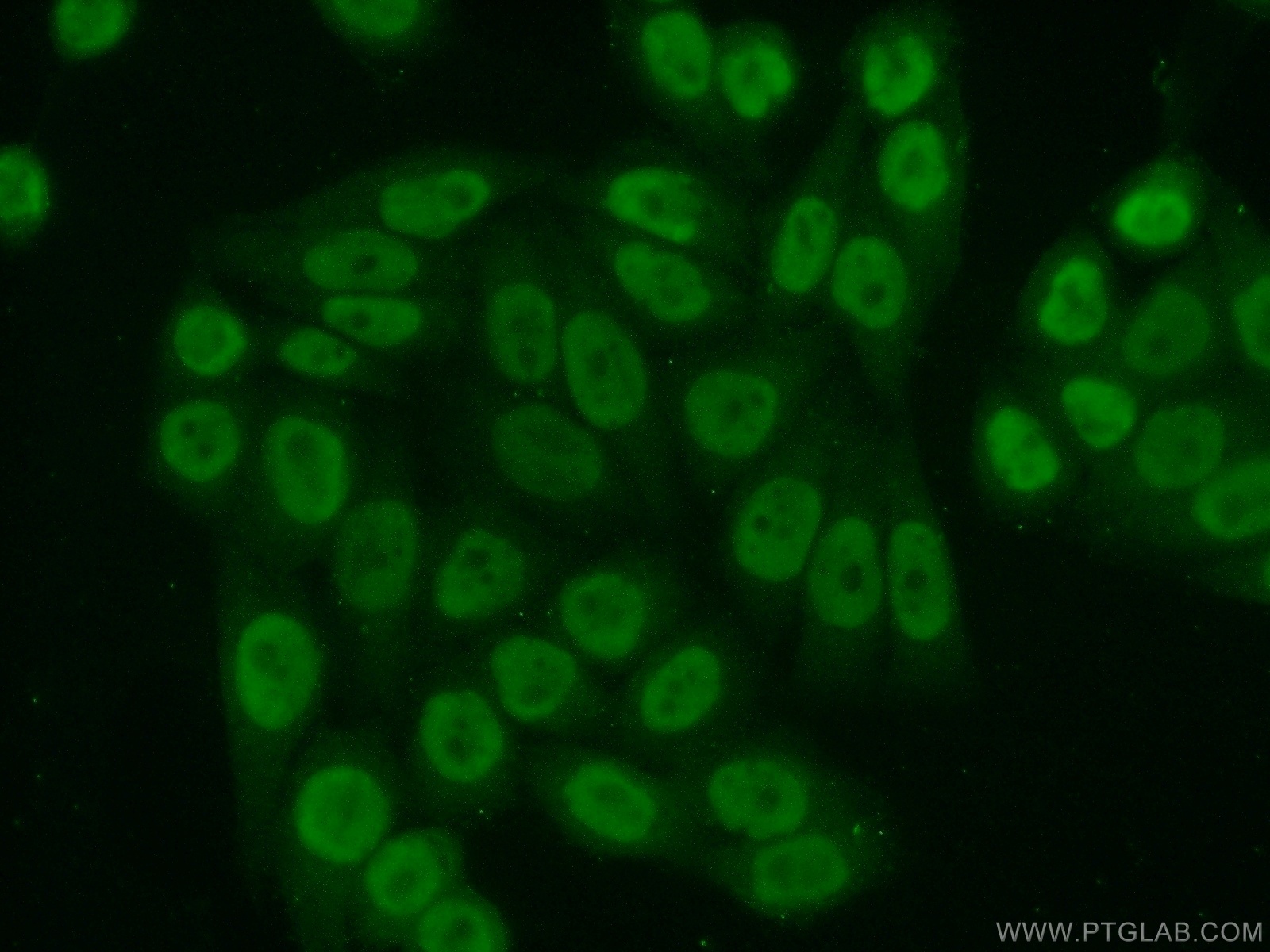 11946-1-AP;HeLa cells