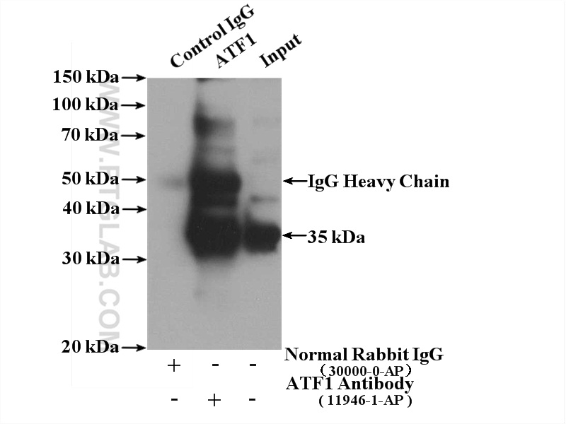 11946-1-AP;HeLa cells