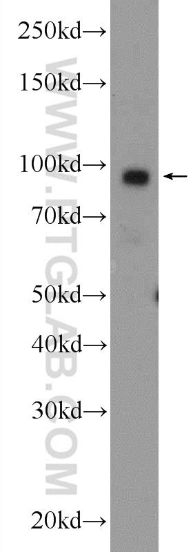 24169-1-AP;MCF-7 cells