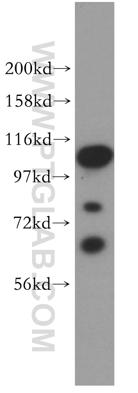 15794-1-AP;Jurkat cell