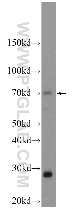 24322-1-AP;mouse spleen tissue