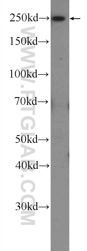 25155-1-AP;HeLa cells