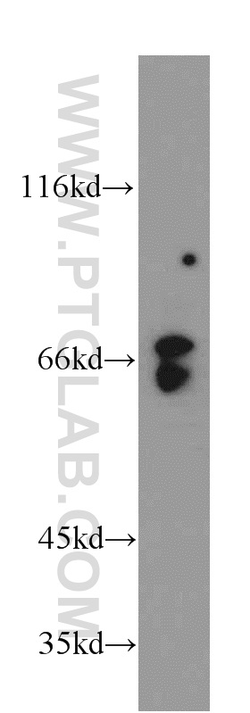 10726-1-AP;HeLa cells